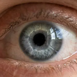 Hazel eye color - hazel iris calculator result example
